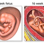 How Long Does Morning Sickness Last?