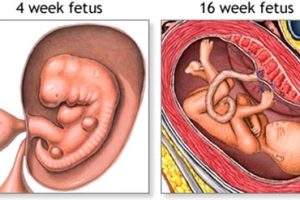 How Long Does Morning Sickness Last?