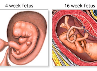 How Long Does Morning Sickness Last?