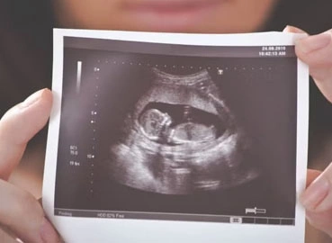 Should I Get an Early PregnancyScan?