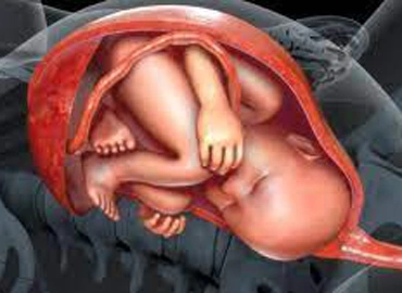 What is Anterior Placenta?